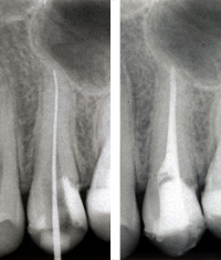 Endodontie in der Zahnarztpraxis Dr. Eichinger, Würzburg